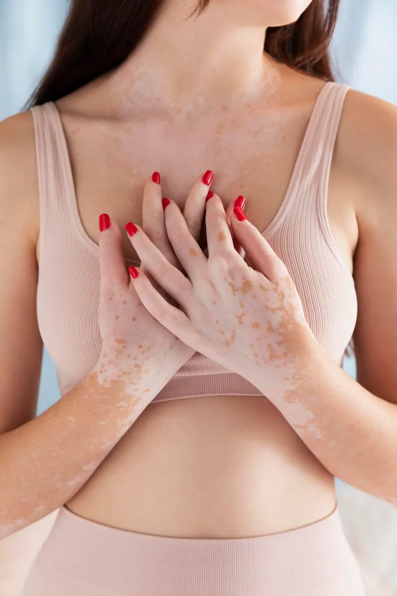 Aconselhamento genético para mutações BRCA1 e BRCA2